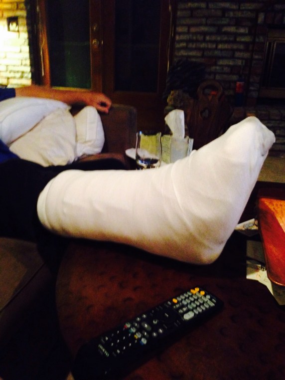 Dad's foot post surgery, totally gnarly bro